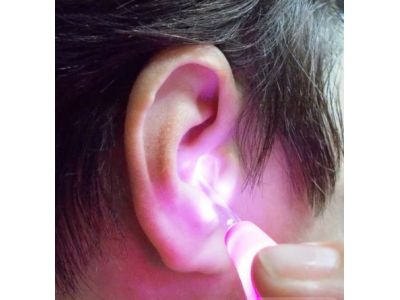 Инструмент для чистки ушей с подсветкой. Фонарик для ушей купить в интернет-магазине «Берегиня» Украина